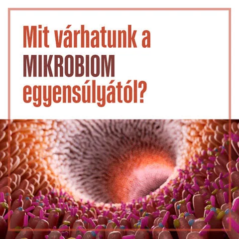 Valódi érték DV